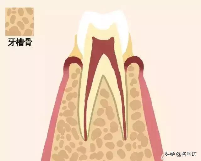 牙齿摔松动怎么办,牙齿松动恢复秘方