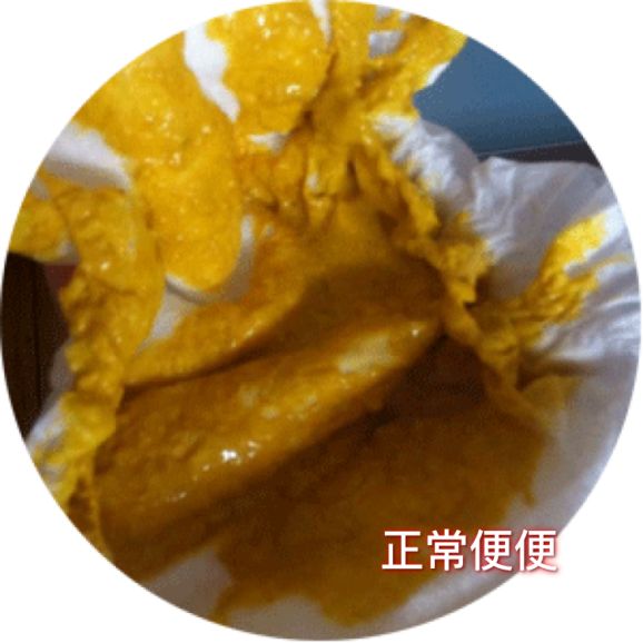 小孩受凉感冒初期中医怎么处理,孩子感冒初期如何快速抑制感冒