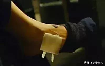 怎么区分黑痣与黑色素瘤,怎么区分黑色素瘤和痦子