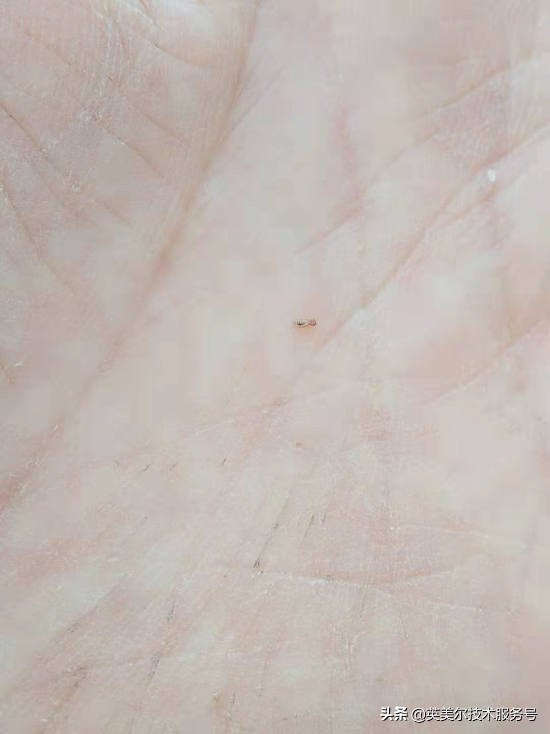 羊身上长虫有什么现象,羊身上有虫用什么药治疗