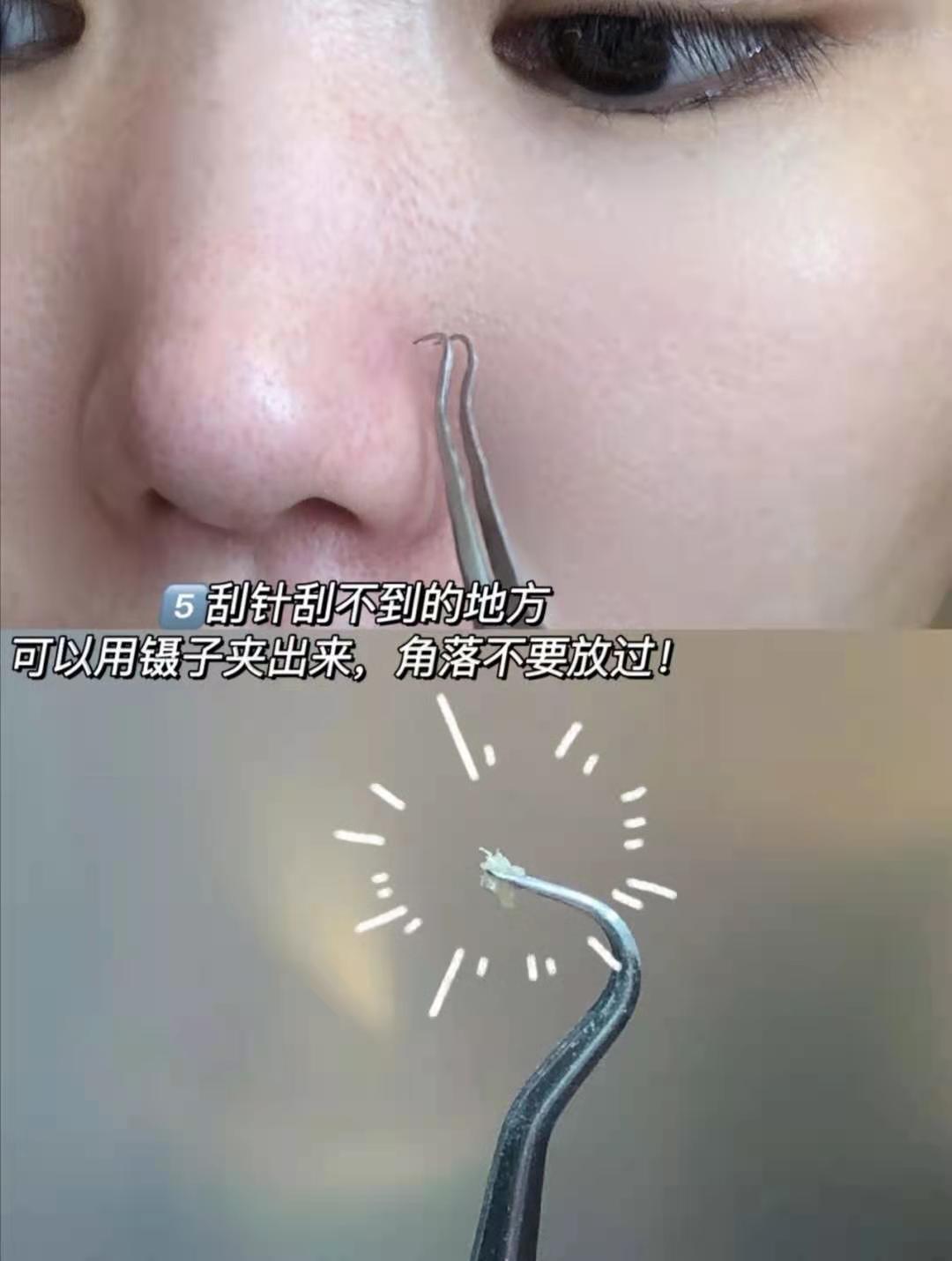 去黑头收缩毛孔测评,去黑头收缩毛孔什么牌子好