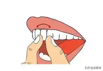 牙周炎才是牙齿松动的罪魁祸首,牙周炎导致全部牙齿脱落镶什么牙