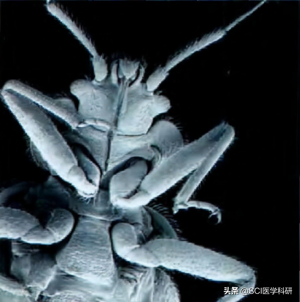 带你了解一下蜘蛛精,吸血虫科普