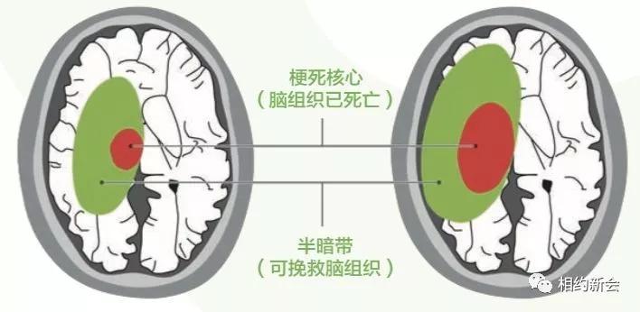 温县人民医院卒中中心,温县第二人民医院视频