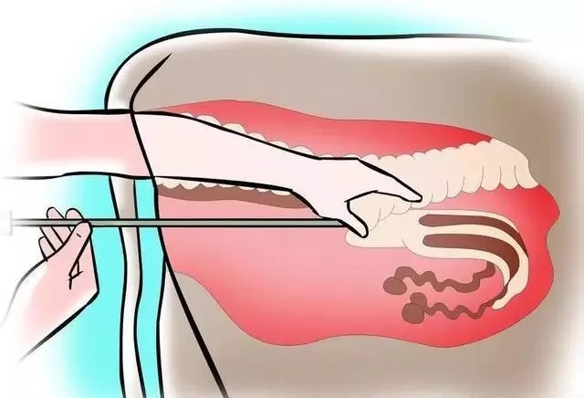 牛人工授精的正确方法和步骤,牛人工授精后两三天流血怎么回事