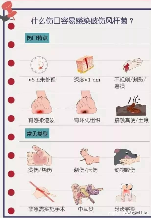 受伤了不打碎伤风有影响吗,受伤了没打碎伤风有什么症状