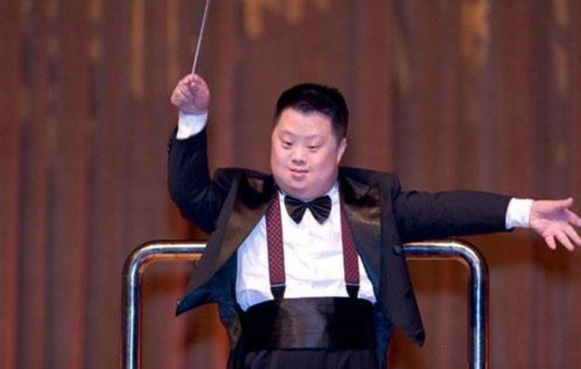 为什么唐氏儿童的脸长得差不多,为什么唐氏患儿长得都一样