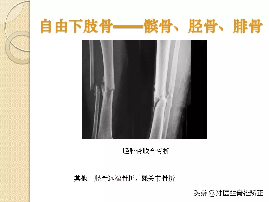 人体解剖学骨骼学思维导图,人体骨骼解剖学纪录片