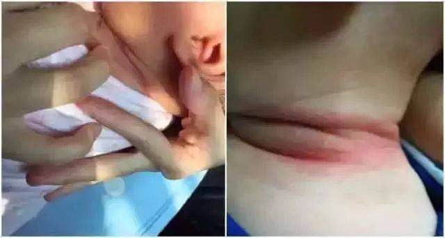 宝宝淹脖子哭闹不止，竟是奶奶惹的祸，这种错误别再犯了