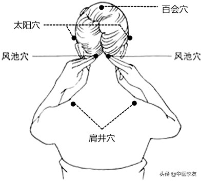 颈椎病引起头疼头晕需要理疗吗,颈椎病晕眩理疗