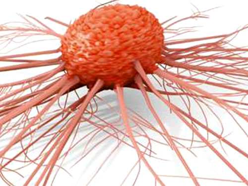 晚期肾癌的中医治疗,肾癌中医治疗处方