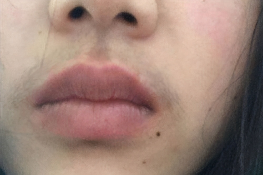 女生长胡子怎么回事？别着急去掉，明确原因再做决定