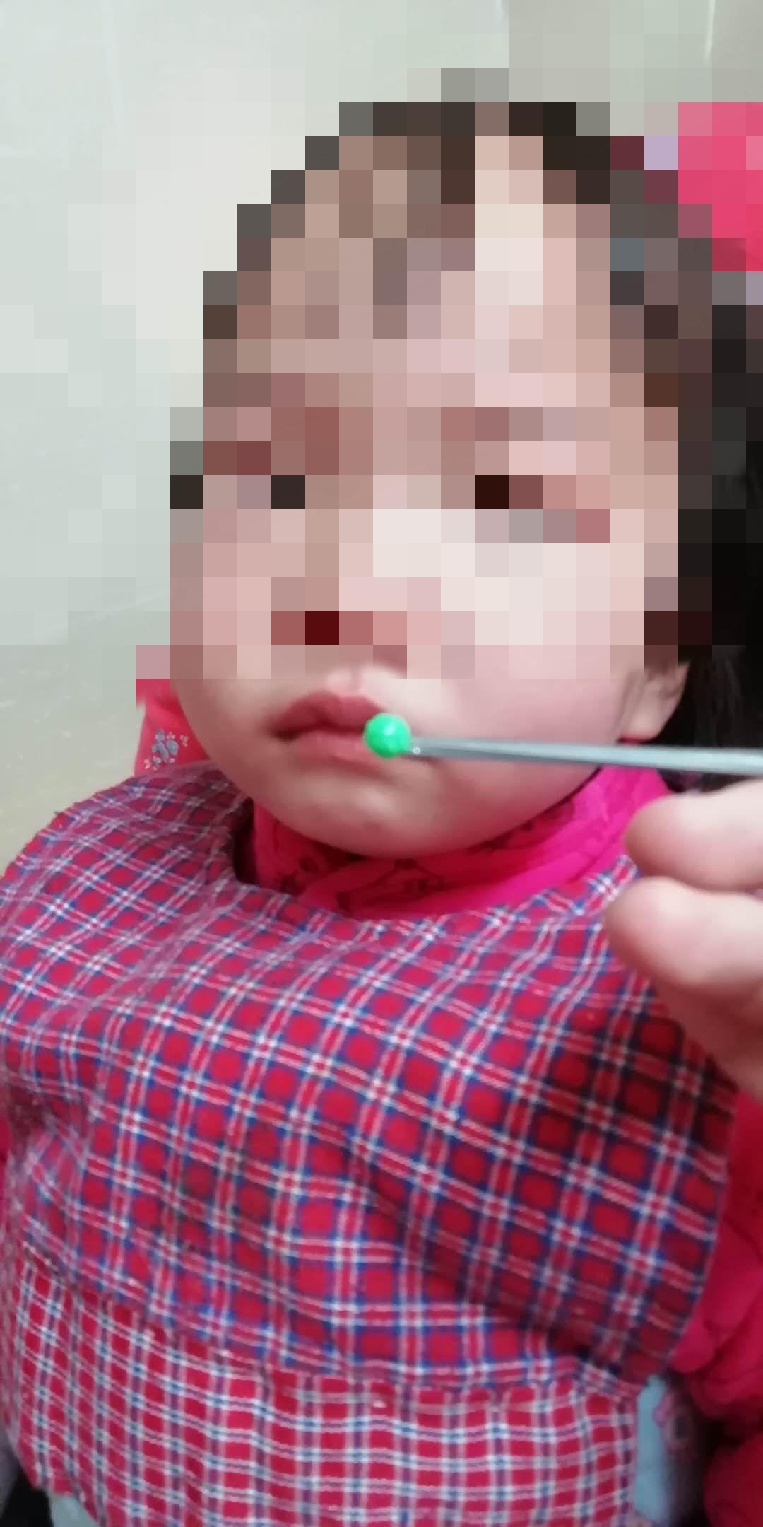 家长关注！徐州多名孩子鼻孔里出现了*珠钢**、西瓜、橡皮泥……