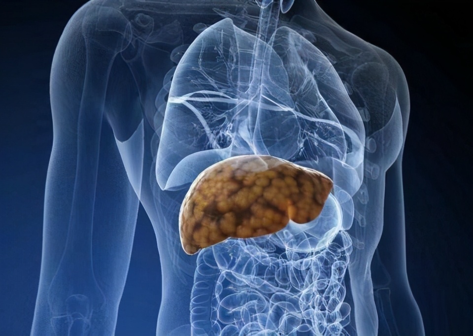 肝病已痊愈能吃护肝药吗,肝病最好护肝药