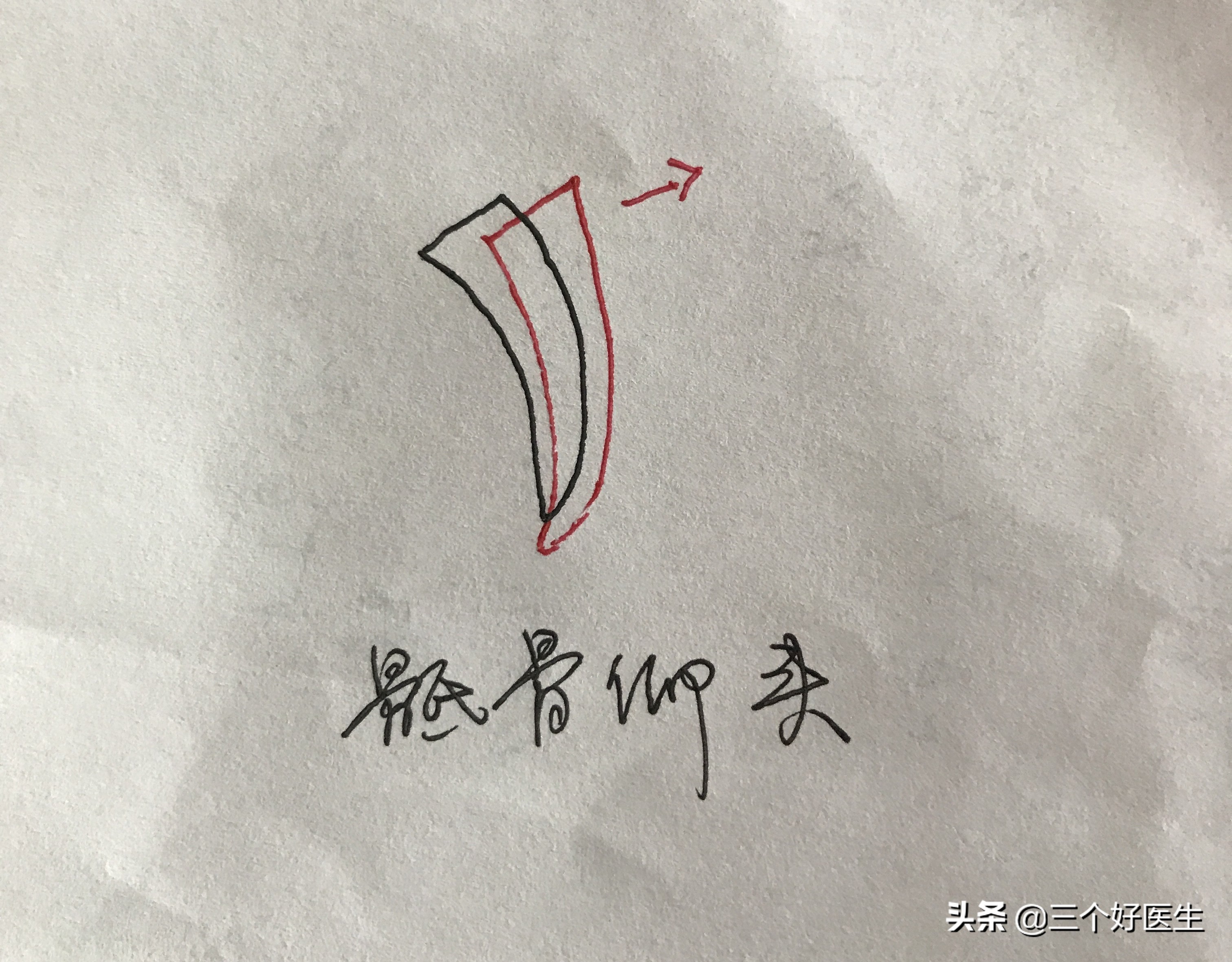 骶骨仰头错位腿会变长吗,骶骨仰头就是骶骨上翘吗