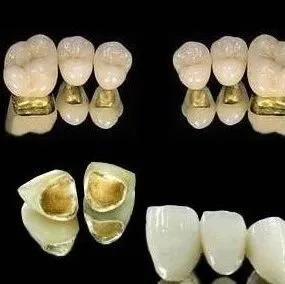 二氧化锆假牙可以做核磁吗,拿不掉的假牙可以做核磁共振么