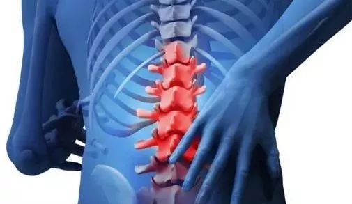 腰扭伤了关注些什么,腰扭伤了最好的办法怎么解决