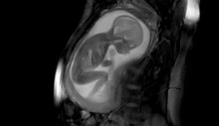 顶尖环境教授：别用塑料袋装外卖，塑料越热，越容易变胖，出大事