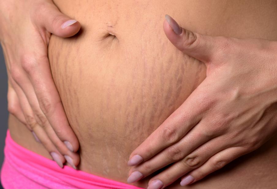 每天这样喝水皮肤越来越好,粉碎哪些护肤谣言