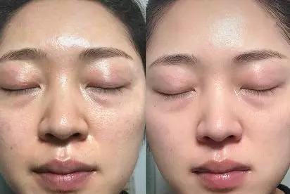 火山泥真是宝，油皮女孩的毛孔疏通剂，让贵妇霜3秒吃透锁水8倍