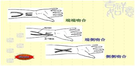 透析是怎么回事,透析是怎么回事视频