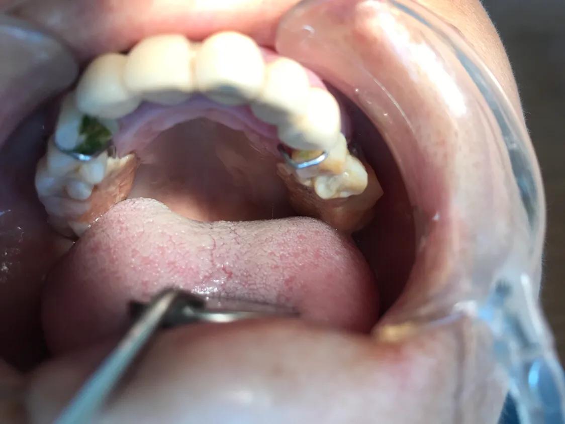 口腔护理中的垃圾怎么分类处理,口腔医疗垃圾和生活垃圾分类