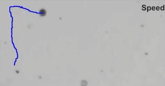 纳米磁控靶向机器人,哈工大肿瘤靶向纳米机器人