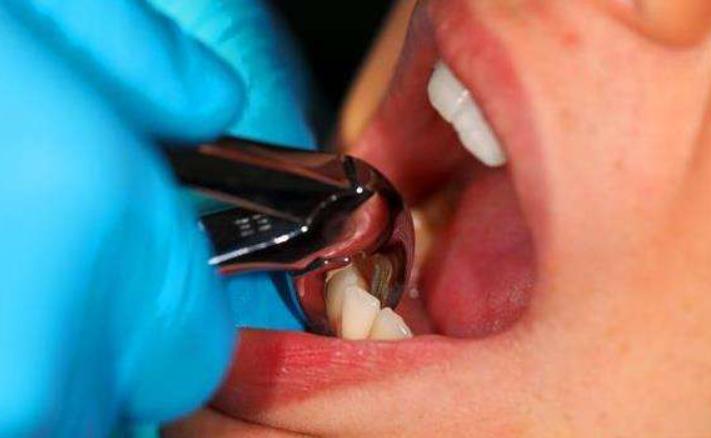 手指被水果刀切伤口很深怎么办,切水果划破手伤口