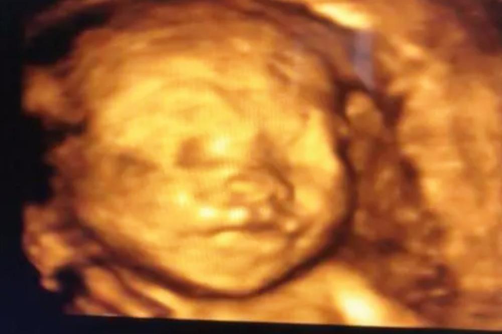 孕期几个月的四维照片最好看,孕期图片胎儿每个月