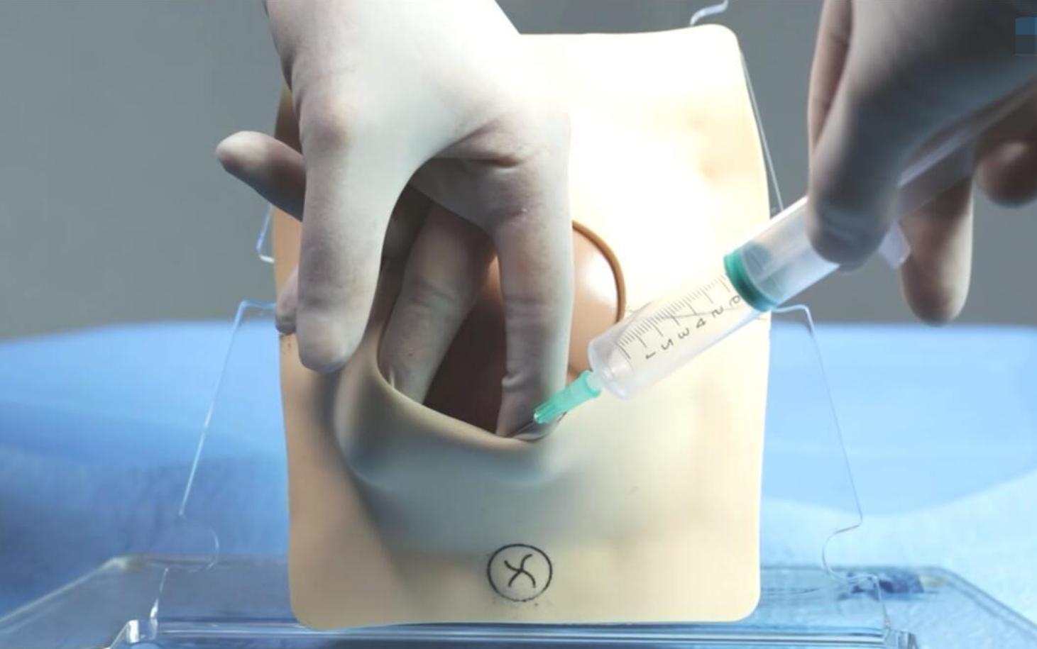 顺产是撕裂好还是侧切好,顺产有撕裂如何判断是否恢复了