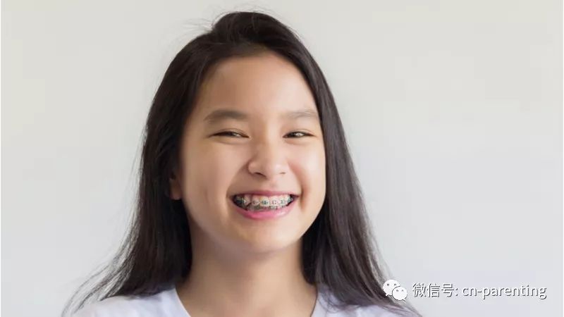 小孩牙矫正的全过程,8岁儿童牙齿矫正兜齿过程全记录