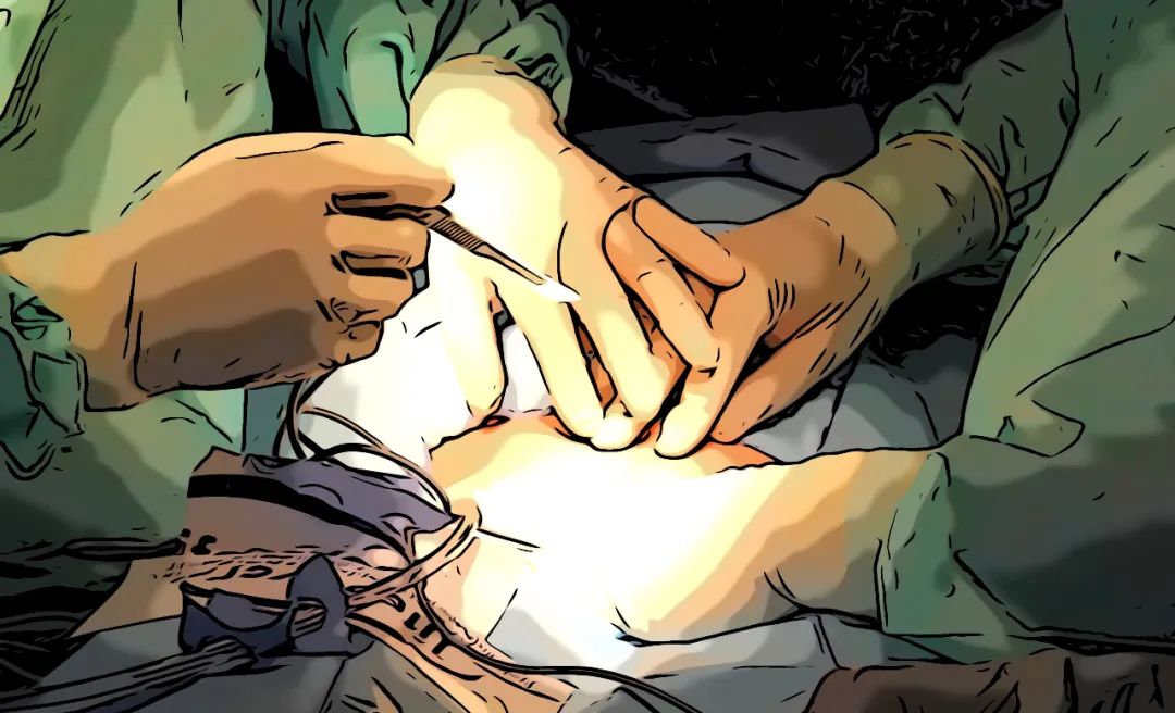 全麻清醒后有什么感觉,全麻手术清醒的感觉