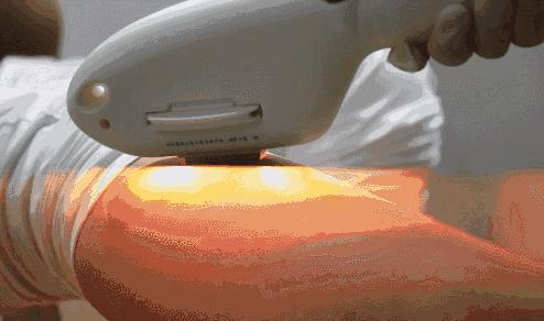 脱毛比较严重怎么办,脱毛快速有效温和