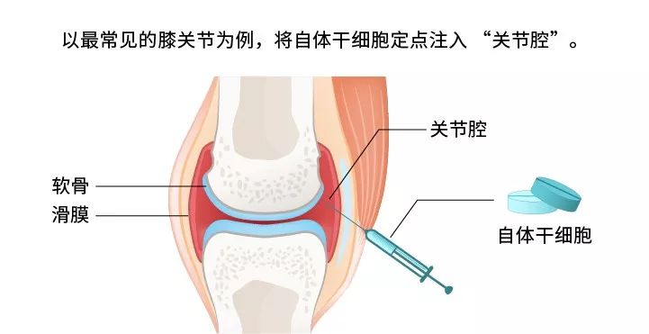 膝盖预知天气,为什么人类能预测未来的天气