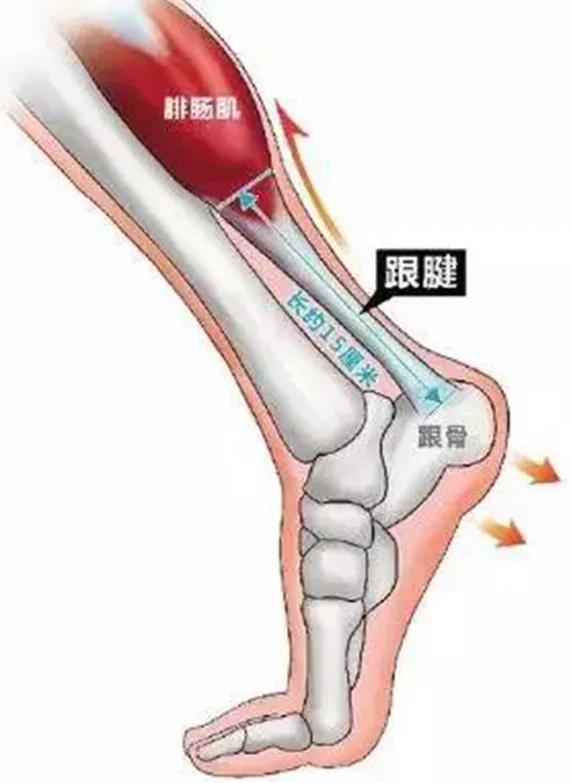跟腱断裂术后康复训练,跟腱断裂恢复的小偏方