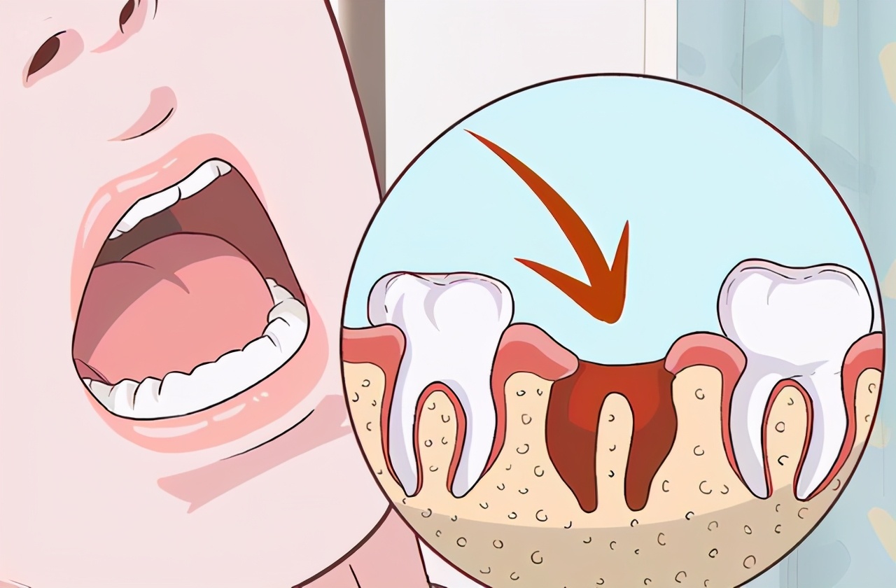 牙痛怎么办早期三大症状,请说出牙痛九个诱因