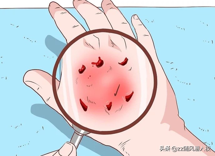 狗咬主人伤口怎么处理,被狗咬了怎么处理狗的伤口