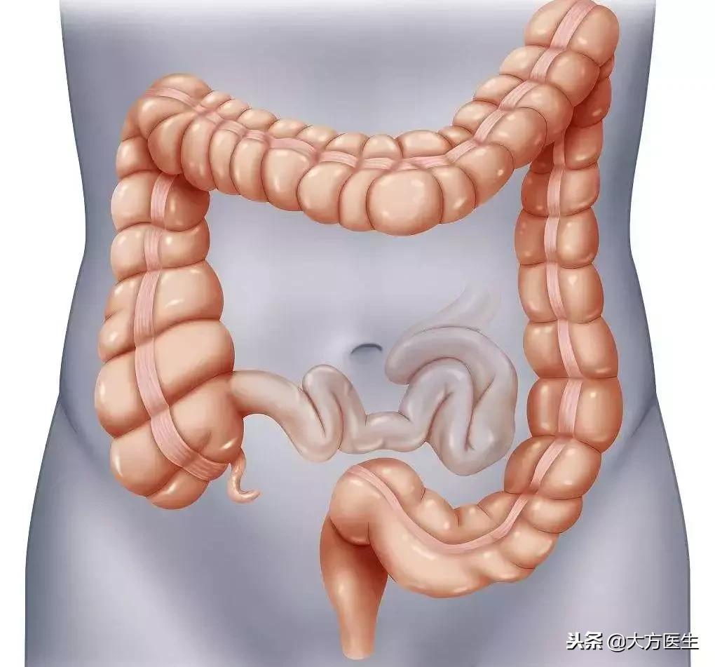 结直肠癌便血一般是什么时期,便血会得什么病