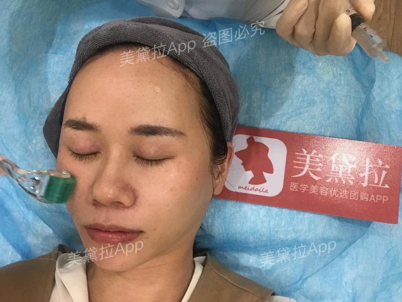 补水保湿美白蛋白精华,美白补水抗皱紧致胶原蛋白