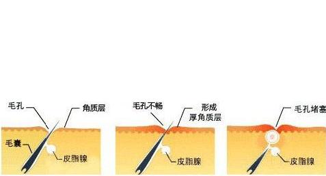 unichi胶原小熊软糖是智商税吗,unichi玫瑰胶原小熊软糖含激素吗