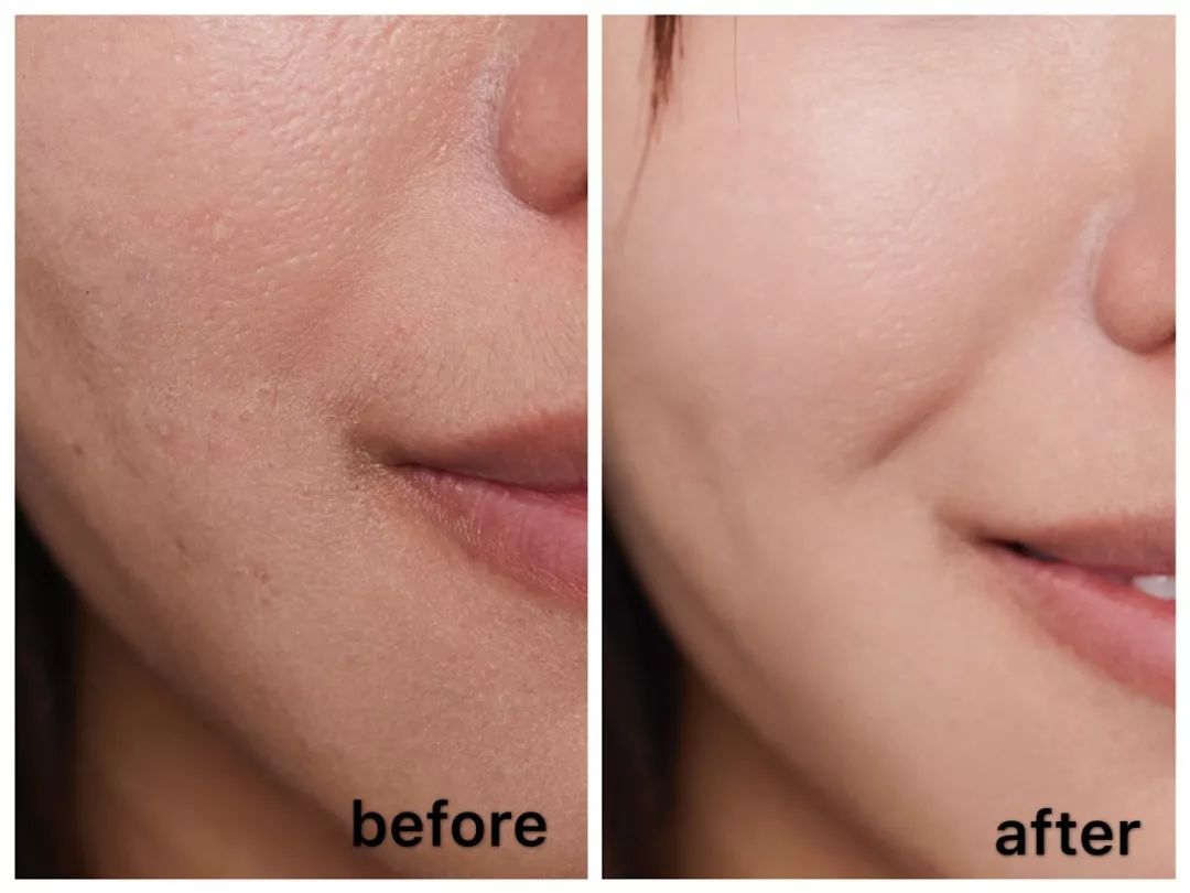 迪丽热巴花期,迪丽热巴青春年华