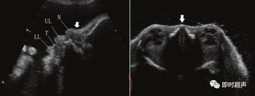 产科常规彩色超声报告单介绍,常见妇科疾病超声报告