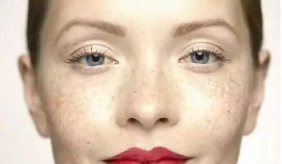 药店几块钱的维生素e能涂脸上嘛,药店几块钱的维生素e