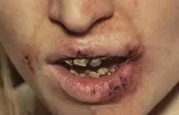 造孽啊！吸毒后的男女如此不堪入目！