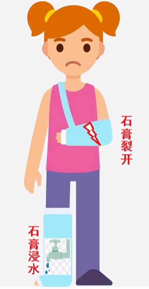 儿童打完石膏要多久复查,幼儿膝盖骨折打石膏关注事项