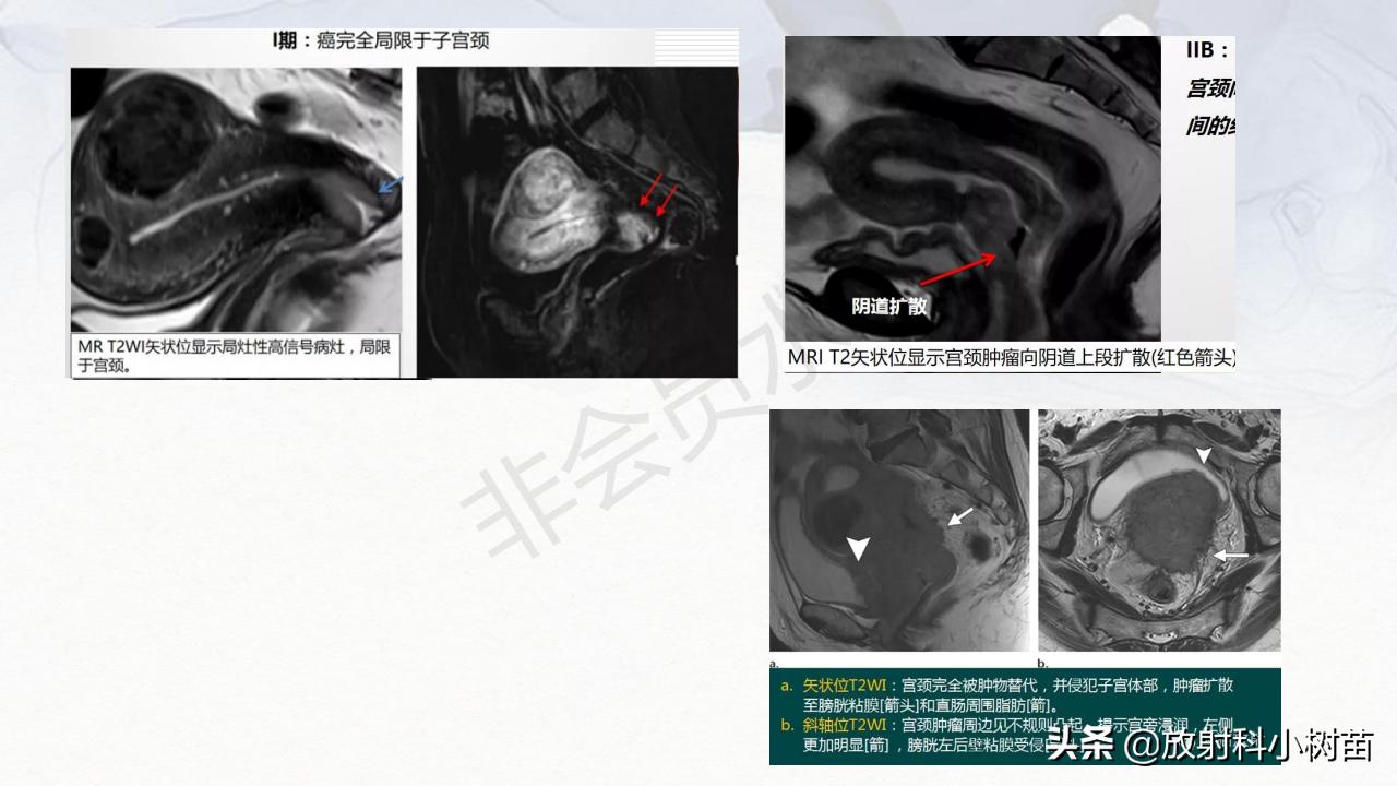 女性盆腔mri解剖图谱,泌尿生殖系统x线解剖
