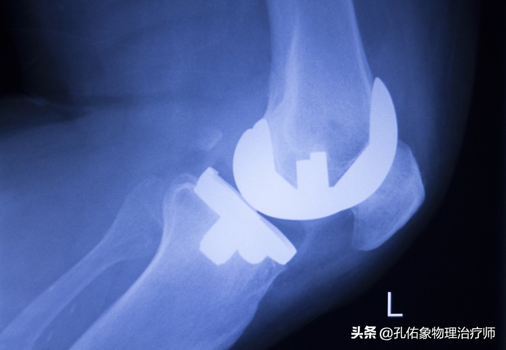 膝疼的最佳治疗方法,如何克服膝痛