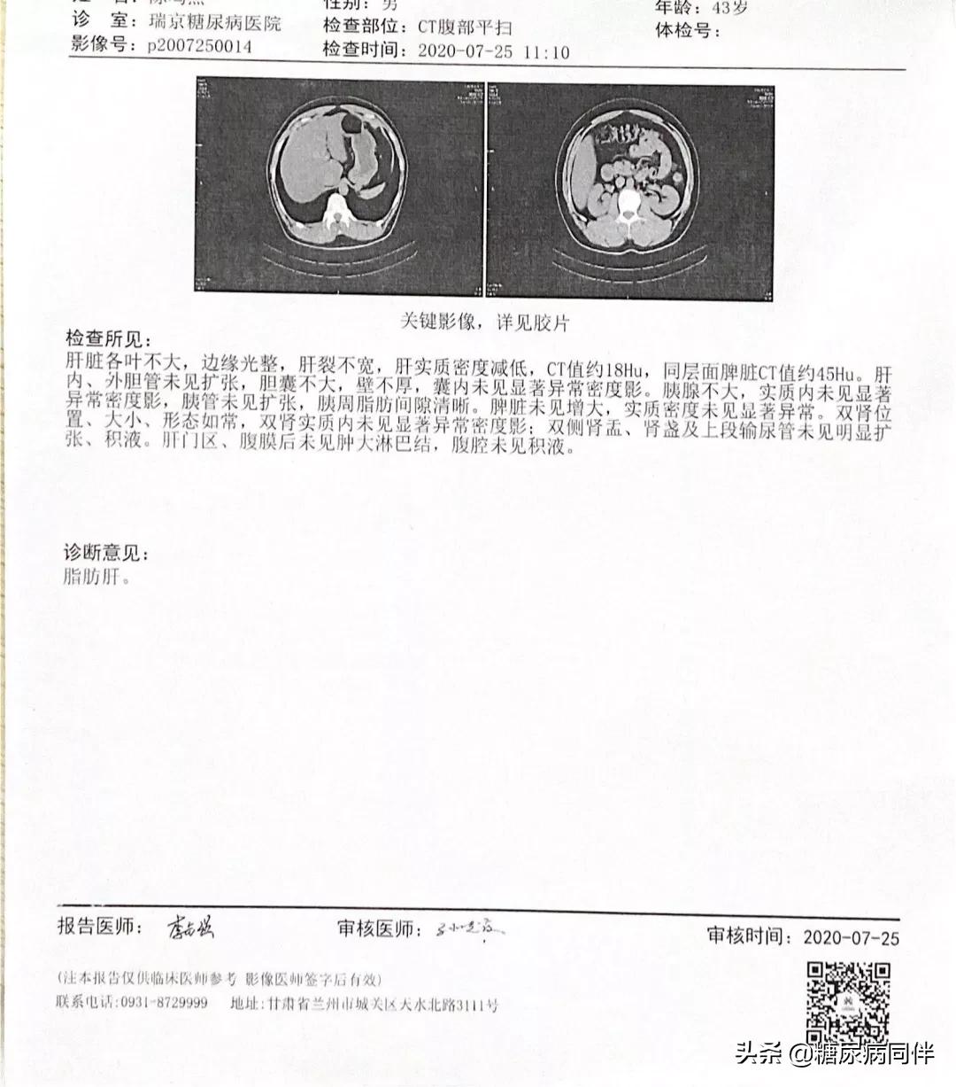 糖尿病新治疗方法逆转,糖尿病的自测与治疗