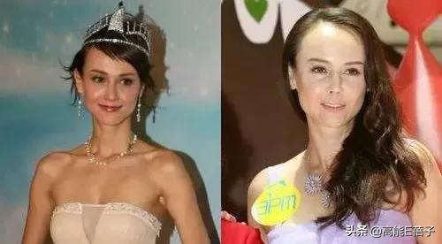 微整形需要多久,最受欢迎的5大微整形