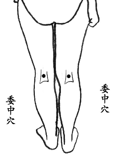 来自民间的点穴急救12法，收藏了吧